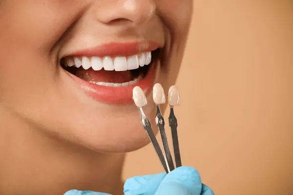 dental veneers in hamilton on